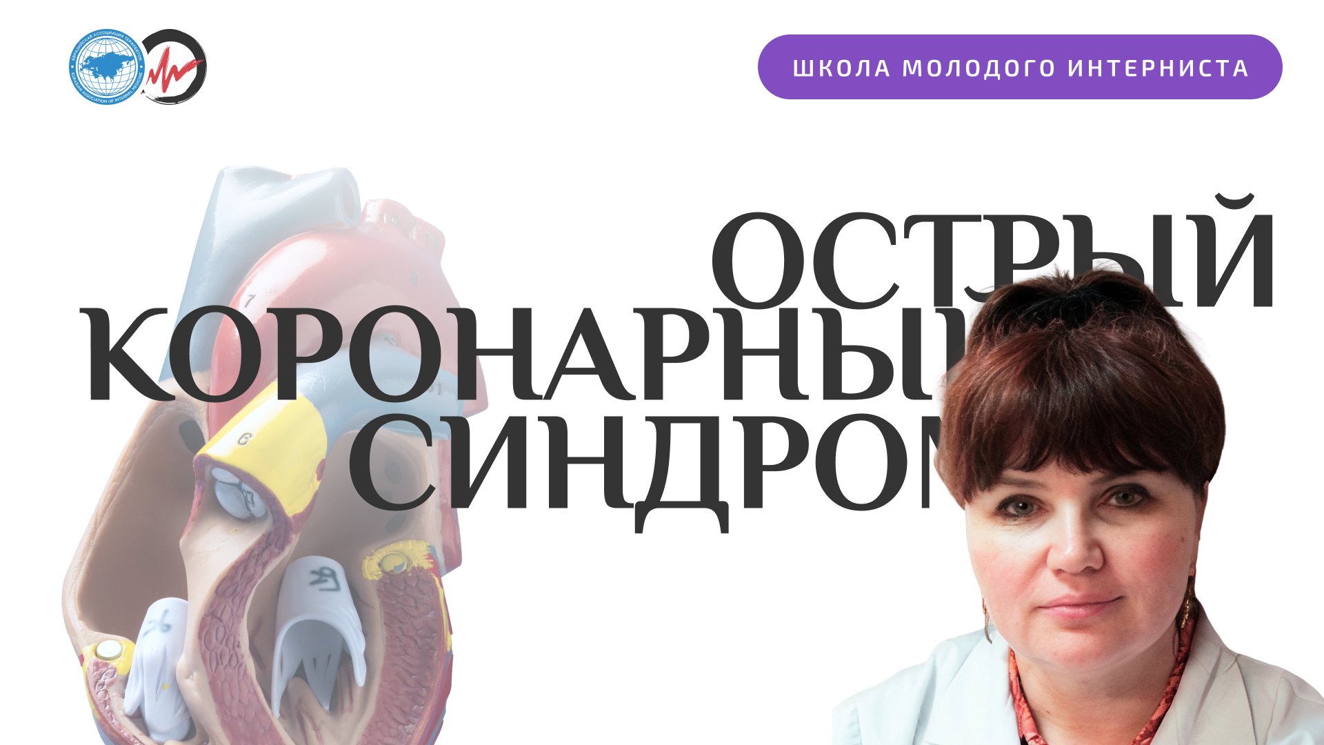 Острый коронарный синдром