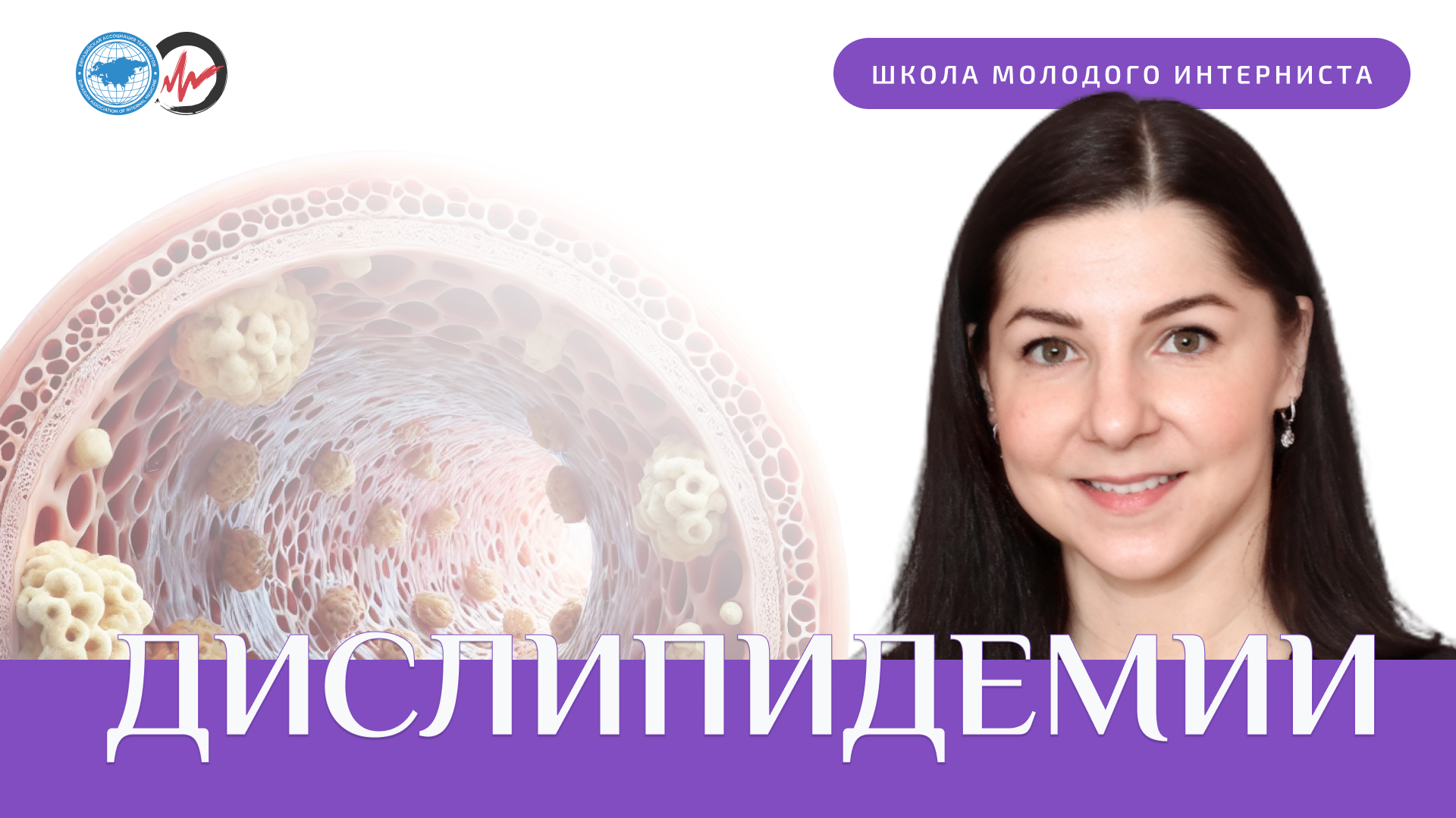 Дислипидемии